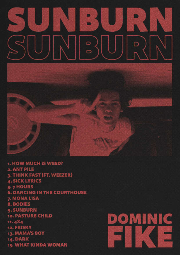 Sunburn